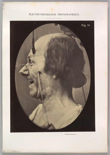 Figure 39: The attention attracted by an object that provokes lascivious ideas and desires.