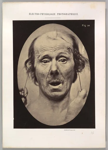 Figure 56: Surprise