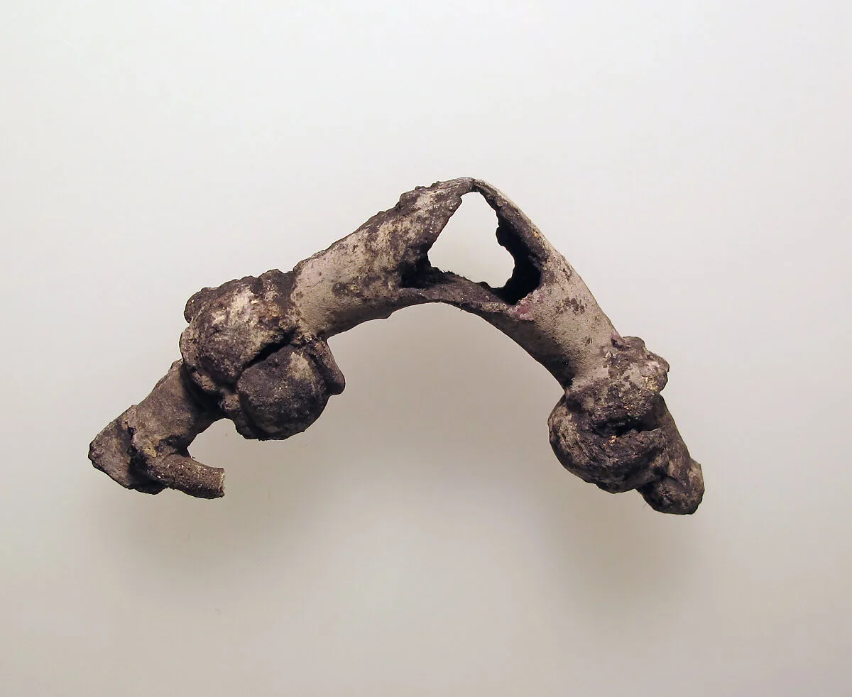 Fibula — Unknown