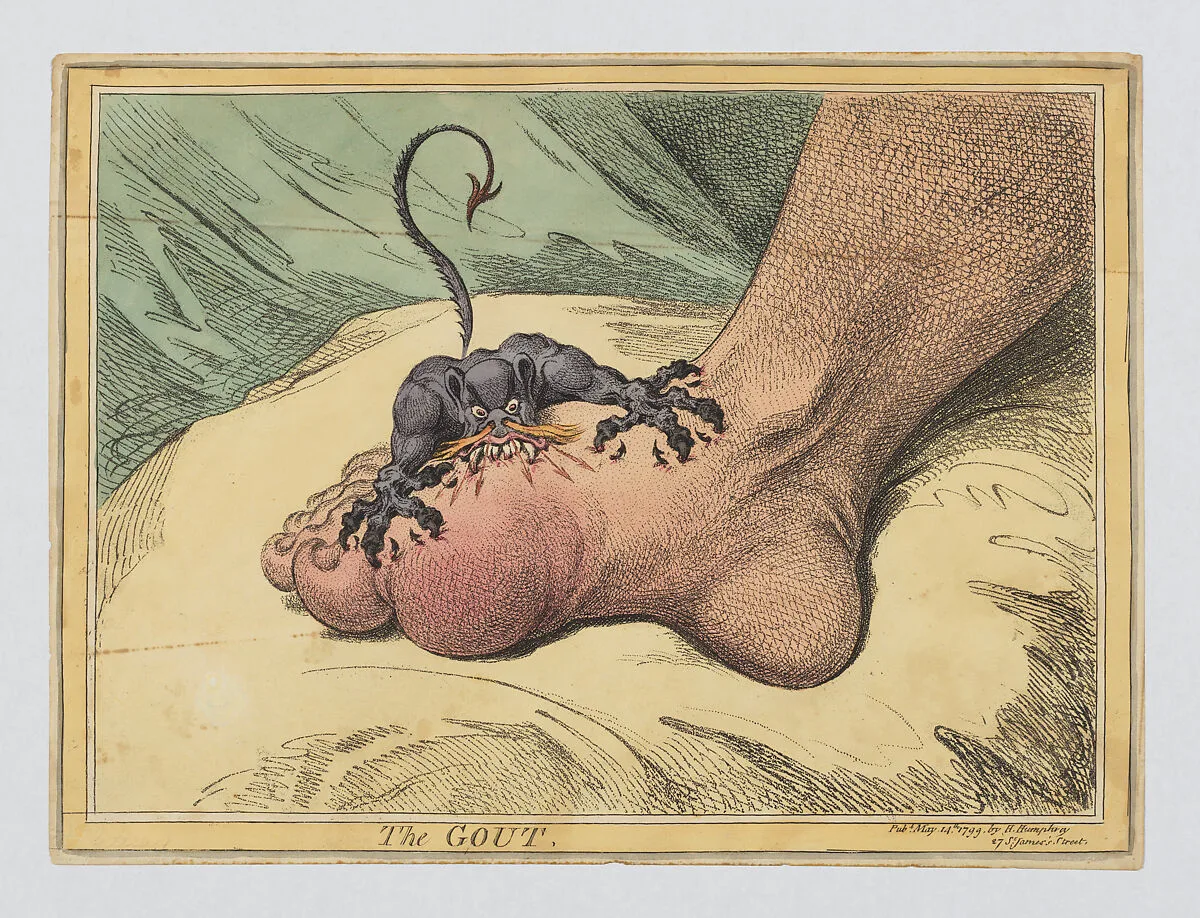 The Gout — Hannah Humphrey|James Gillray