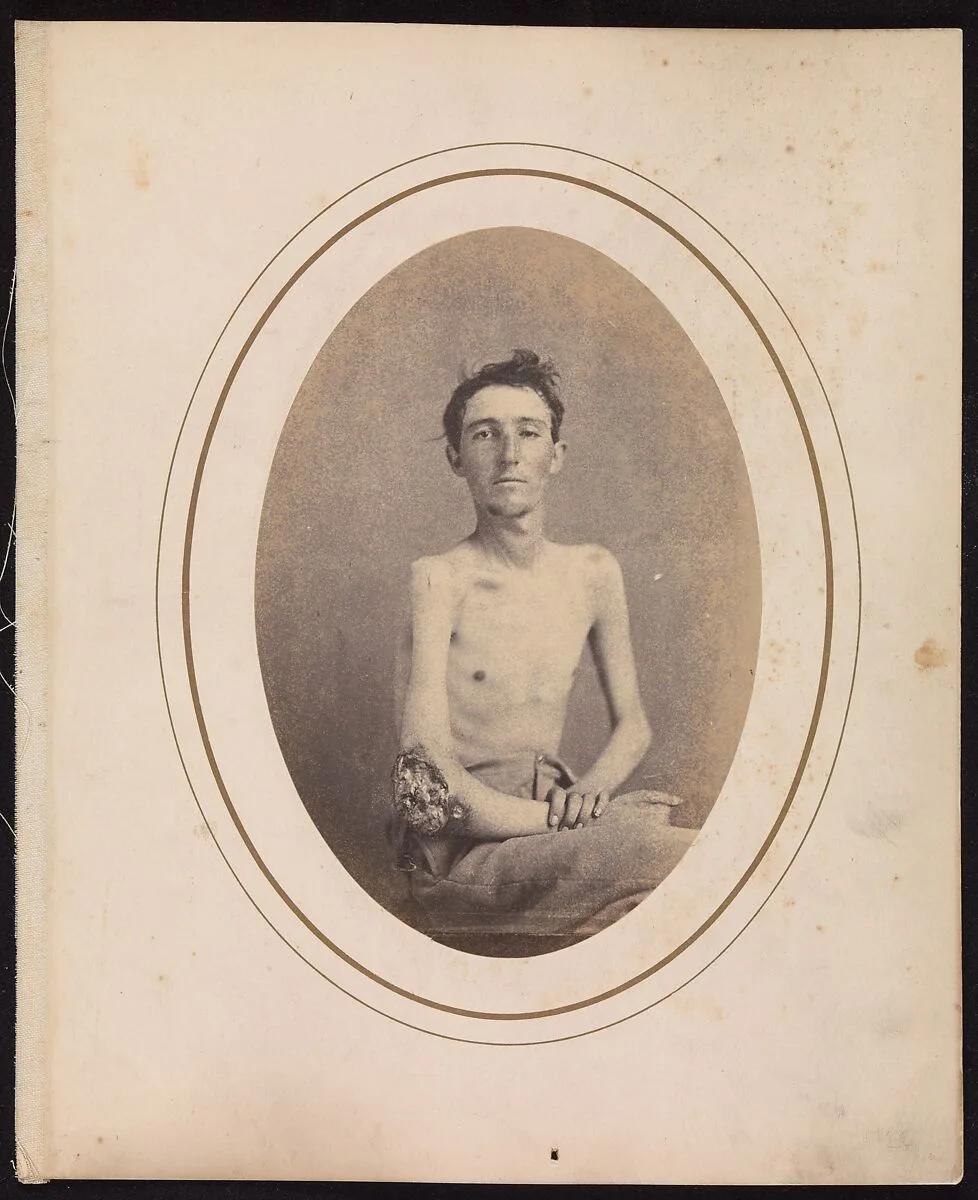 Private James H. Stokes, Company H, 185th New York Volunteers — Reed Brockway Bontecou