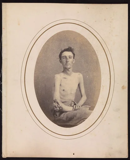 Private James H. Stokes, Company H, 185th New York Volunteers