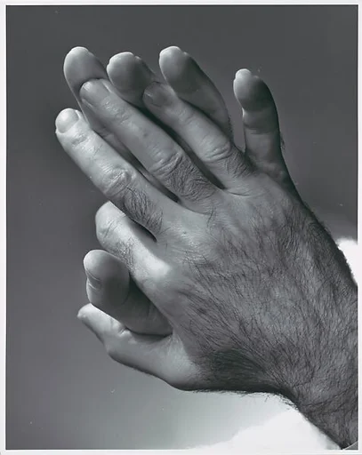 The Hands of Dr. Michael De Bakey