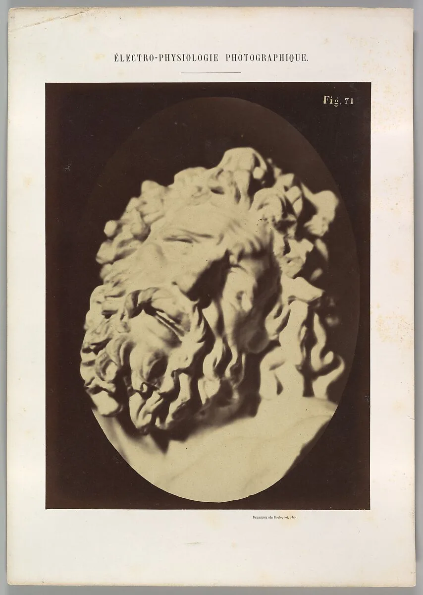 Figure 71: Same head as in Plate 70 — Guillaume-Benjamin-Amand Duchenne de Boulogne|Adrien Tournachon