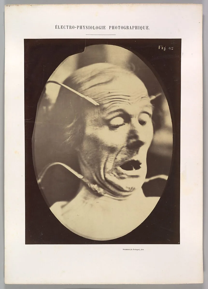 Figure 62: Terror, semiprofile — Guillaume-Benjamin-Amand Duchenne de Boulogne|Adrien Tournachon
