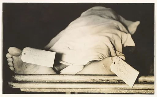 [John Dillinger's Feet, Chicago Morgue]