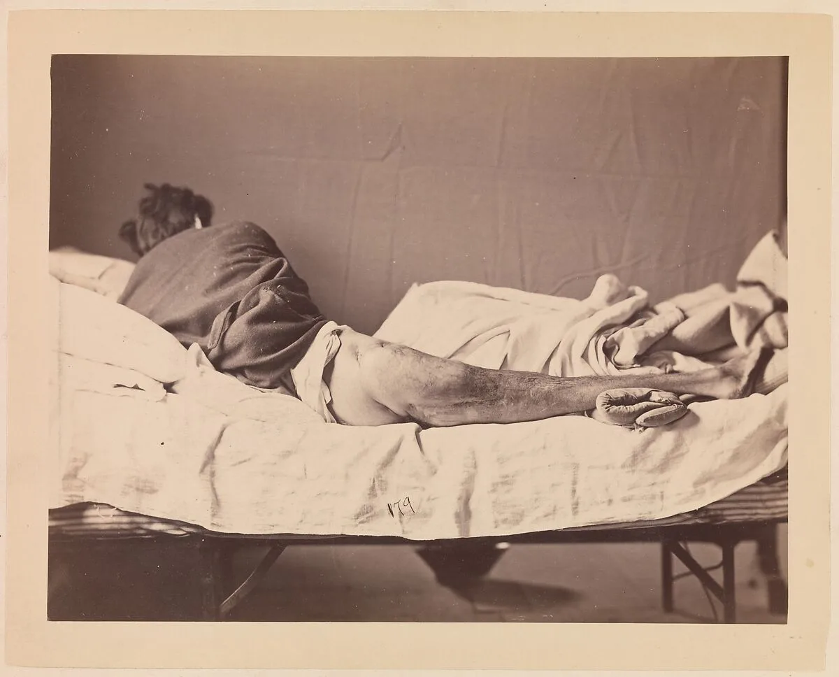 Private George Ruoss, Co. G, 7th New York Volunteers — Reed Brockway Bontecou