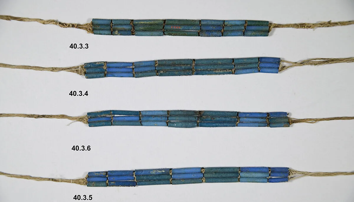 Anklet of Wah — Unknown