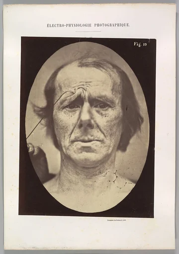 Figure 19: Suffering