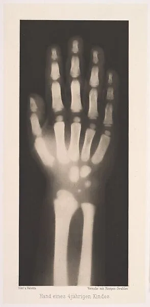 Hand eines 4 jährigen Kindes — Josef Maria Eder|Eduard Valenta