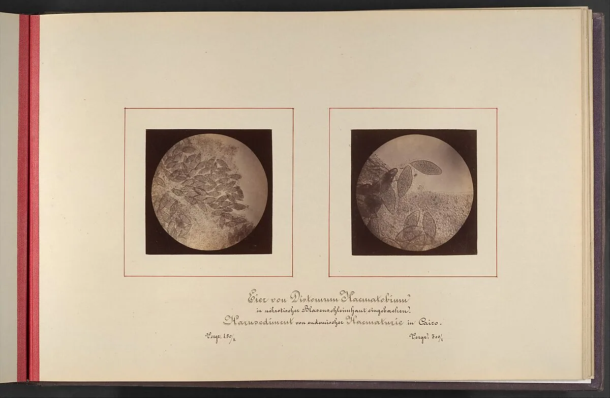 Mikroskopisch-Photographischer Atlas der Harnsedimente — Robert Ultzmann