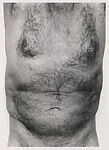 Torso, Front — John Coplans
