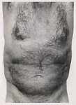 Torso, Front