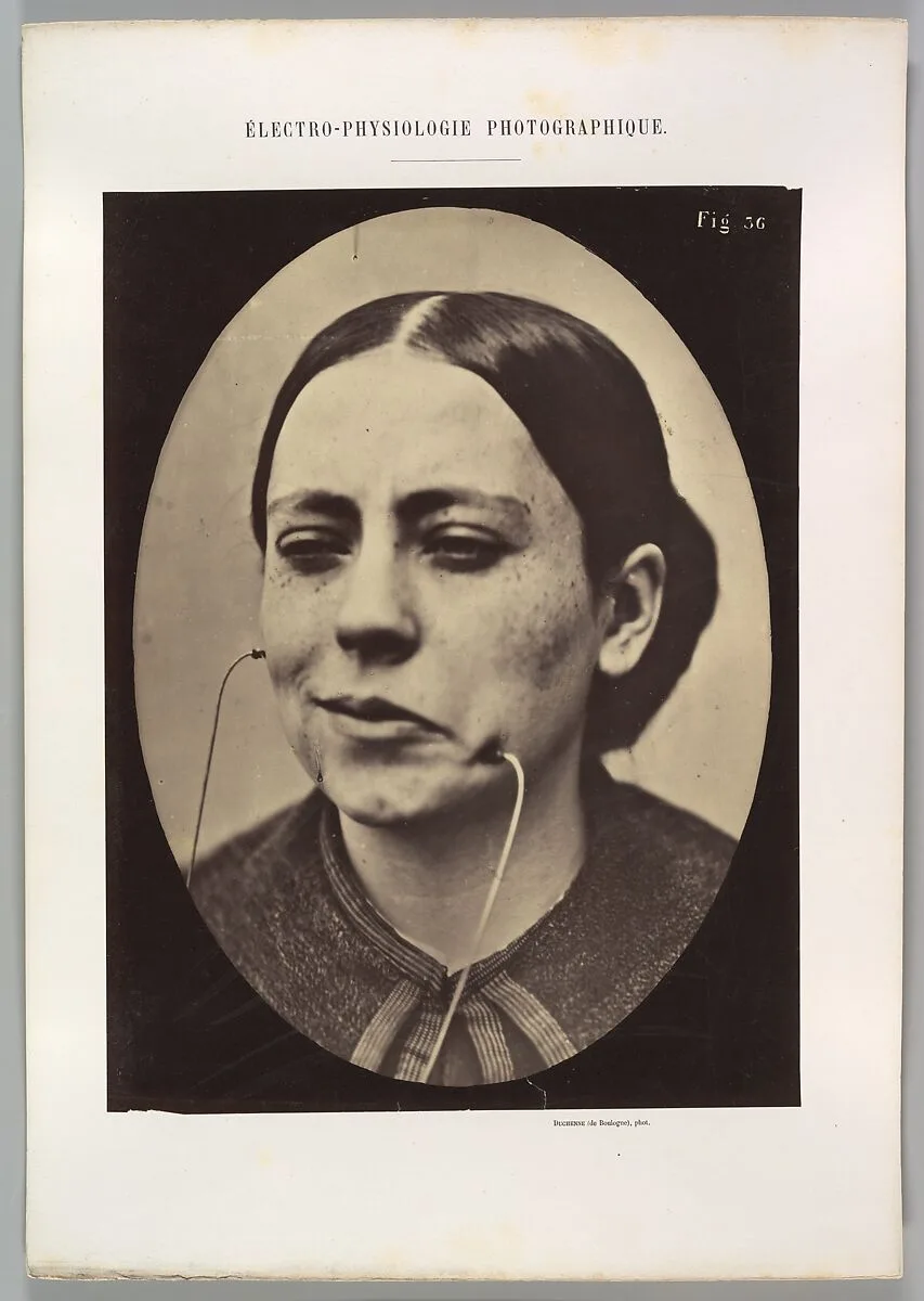 Figure 36: Scornful laughter and scornful disgust — Guillaume-Benjamin-Amand Duchenne de Boulogne|Adrien Tournachon