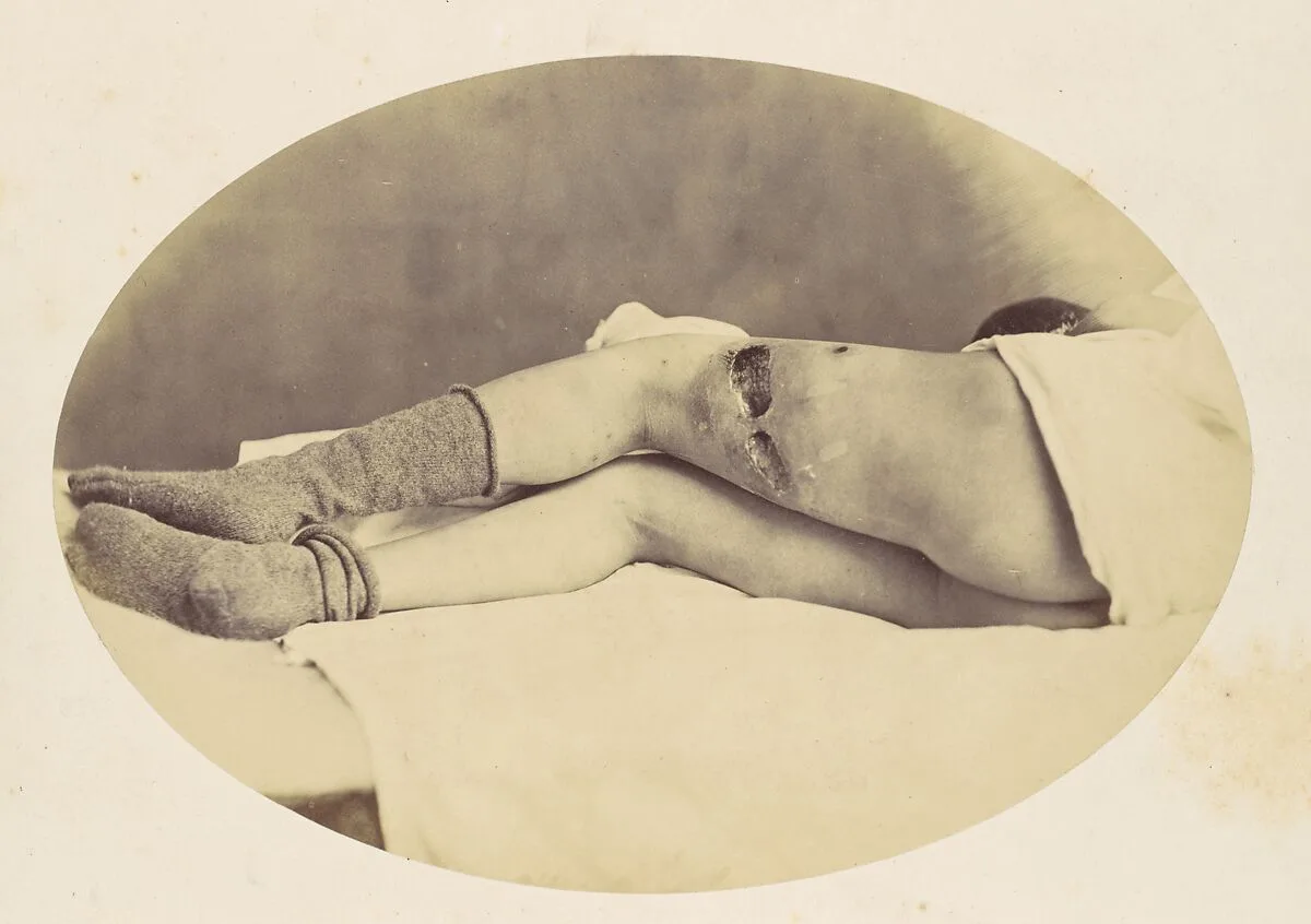 Judson C. Albright — Reed Brockway Bontecou