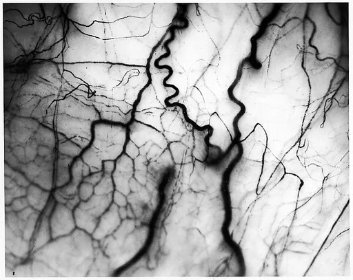 [Detail of Veins in Human Eyeball]