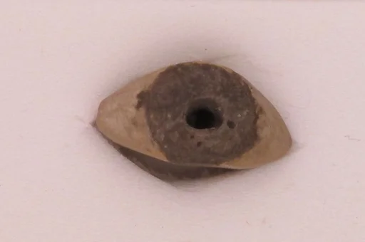 Eye inlays