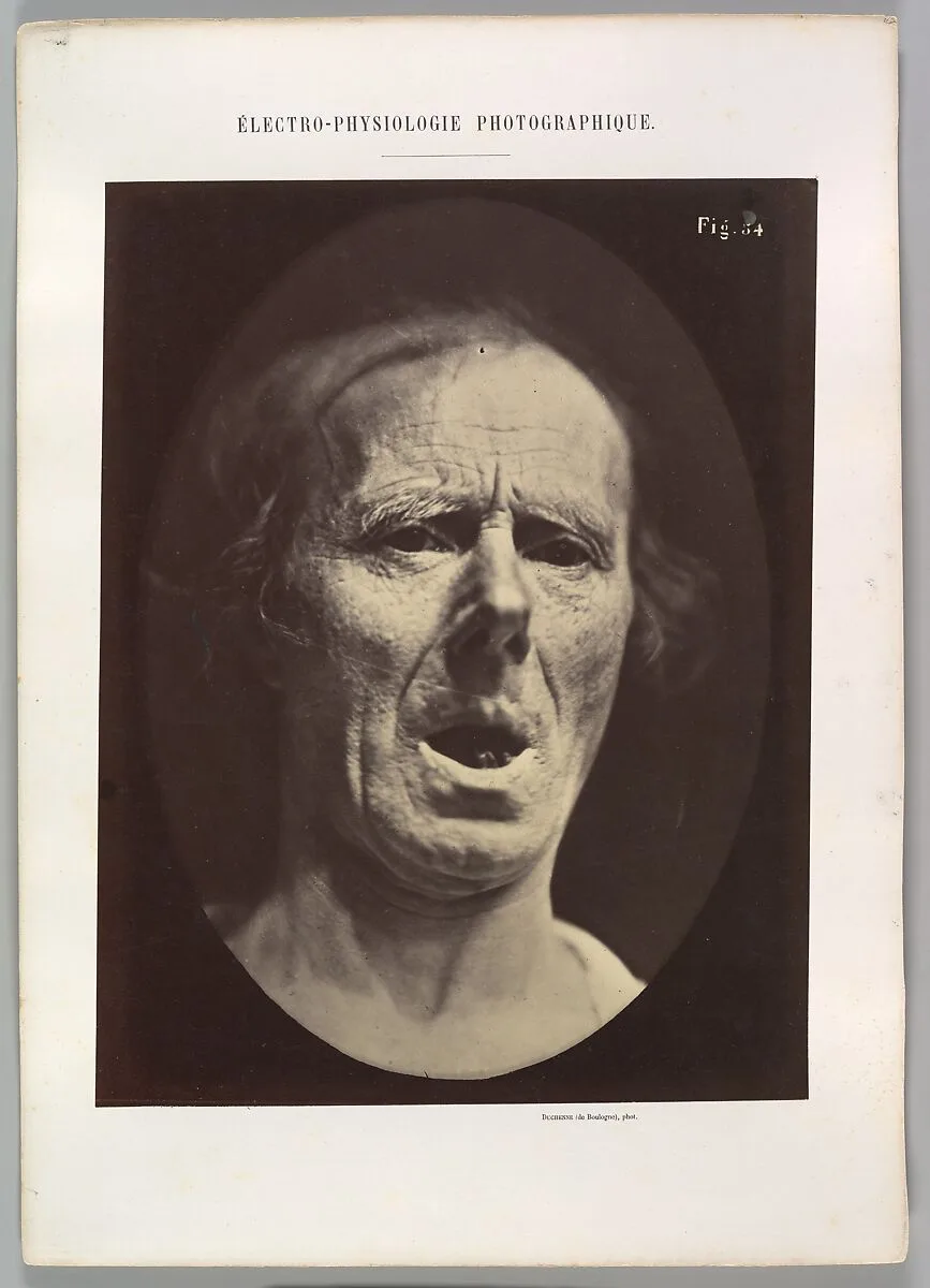Figure 54: Voluntary lowering of the lower jaw — Guillaume-Benjamin-Amand Duchenne de Boulogne|Adrien Tournachon