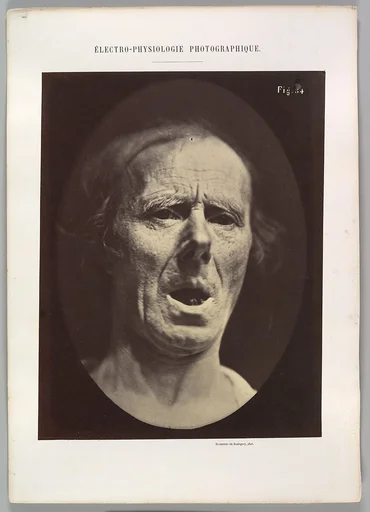 Figure 54: Voluntary lowering of the lower jaw