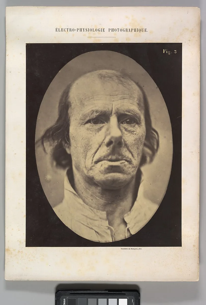 Figure 3: The face of an old man... photographed in repose. — Guillaume-Benjamin-Amand Duchenne de Boulogne|Adrien Tournachon