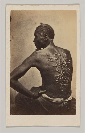 Gordon or "The Scourged Back"