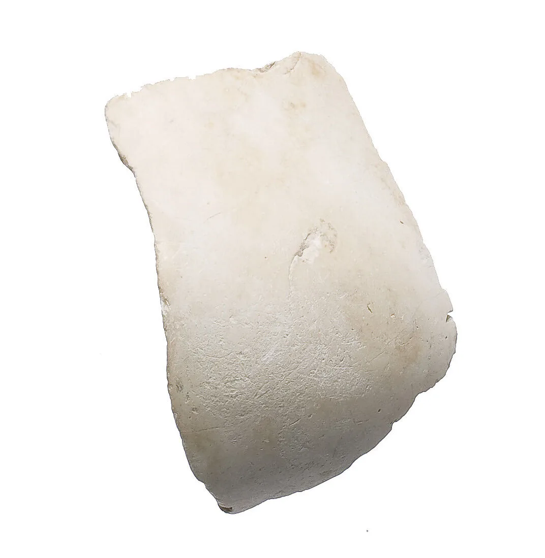 Elbow or shoulder — Unknown