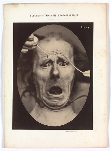 Electro–Physiologie, Figure 64