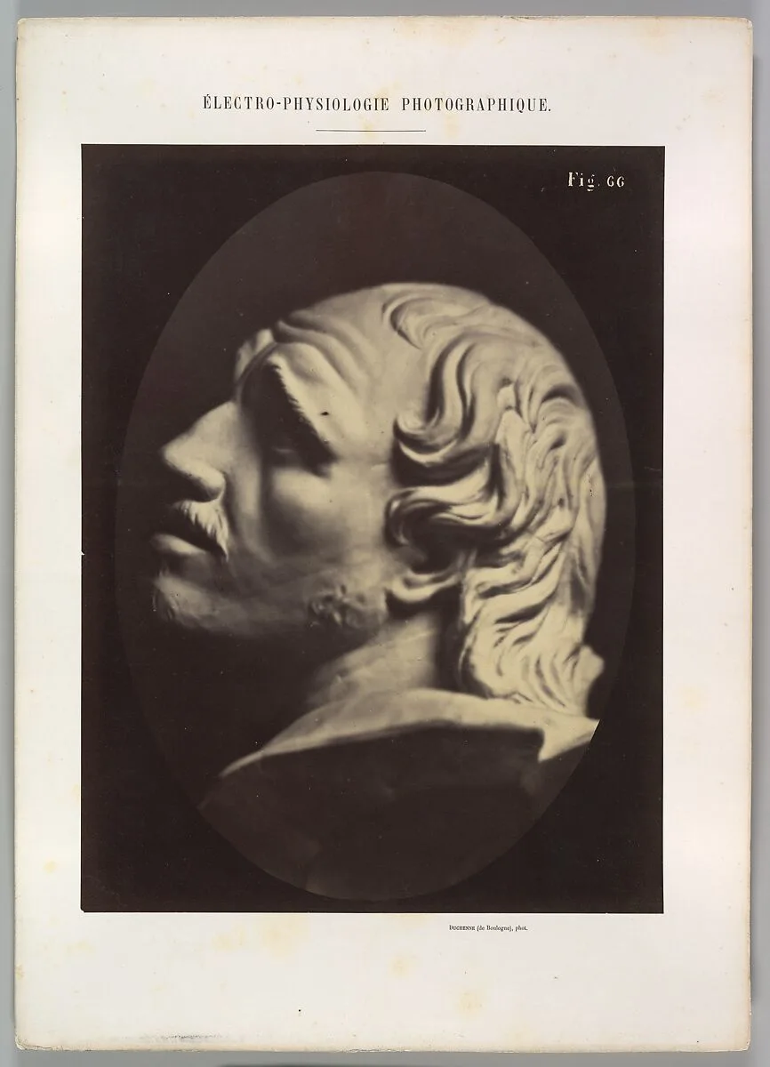 Figure 66: Head of Arrotino (the spy, the knife grinder, and so on) — Guillaume-Benjamin-Amand Duchenne de Boulogne|Adrien Tournachon