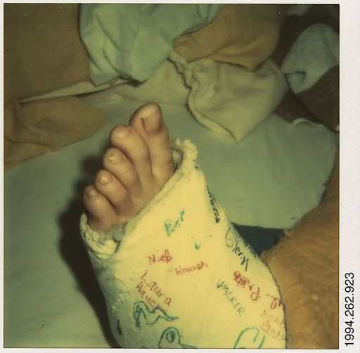 [Foot in Cast: Glenn Ives?]