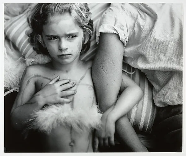 Jessie Bites — Sally Mann