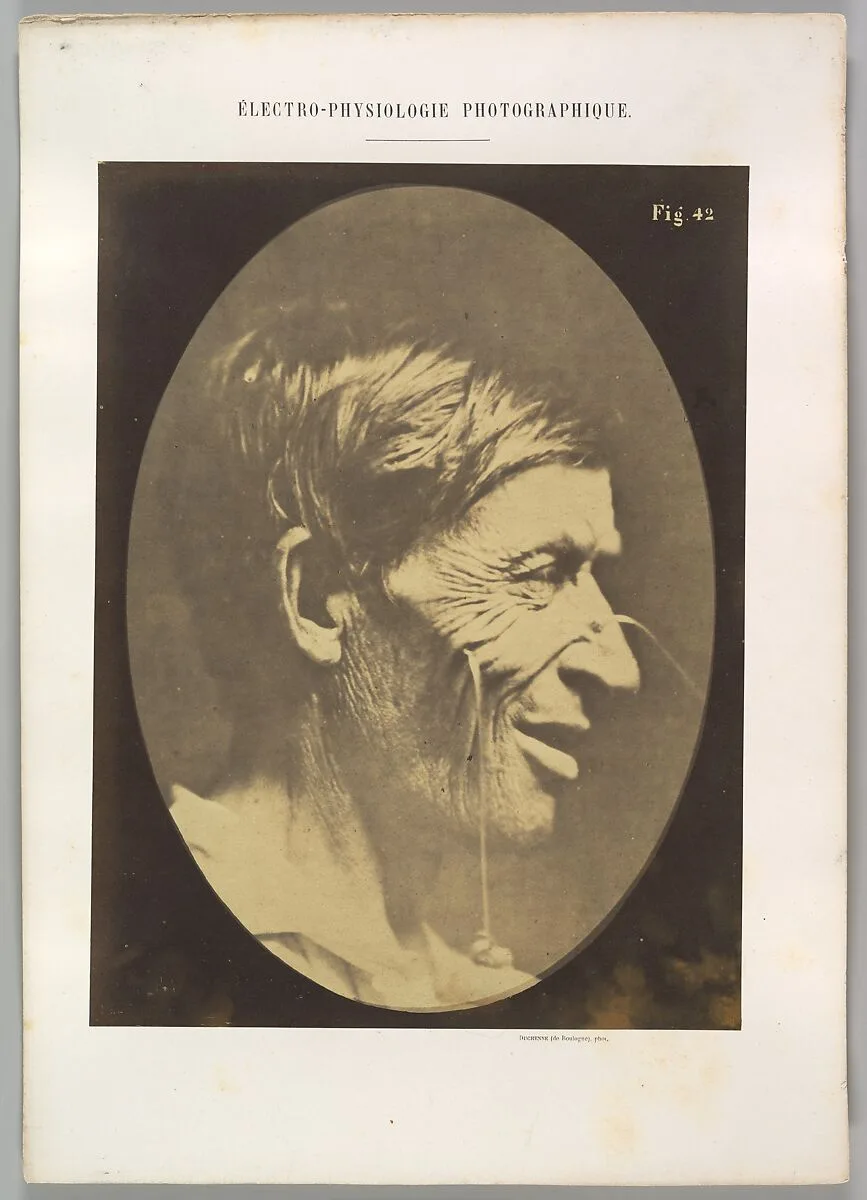 Figure 42: Gaiety expressed by the ideas of lustfulness, cynicism, and lewdness. — Guillaume-Benjamin-Amand Duchenne de Boulogne|Adrien Tournachon