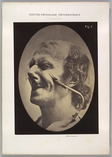 Figure 6: The grimice produced is similar to a tic of the face