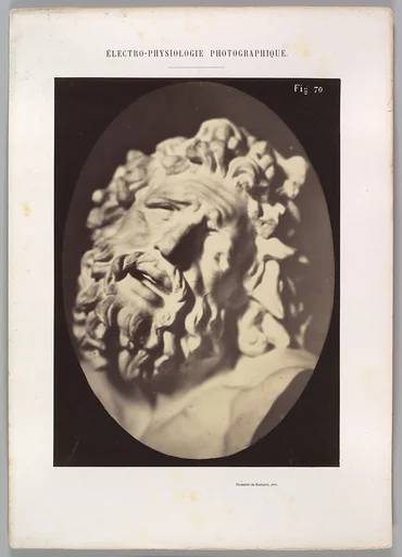 Figure 70: Head of the Laocoön of Rome