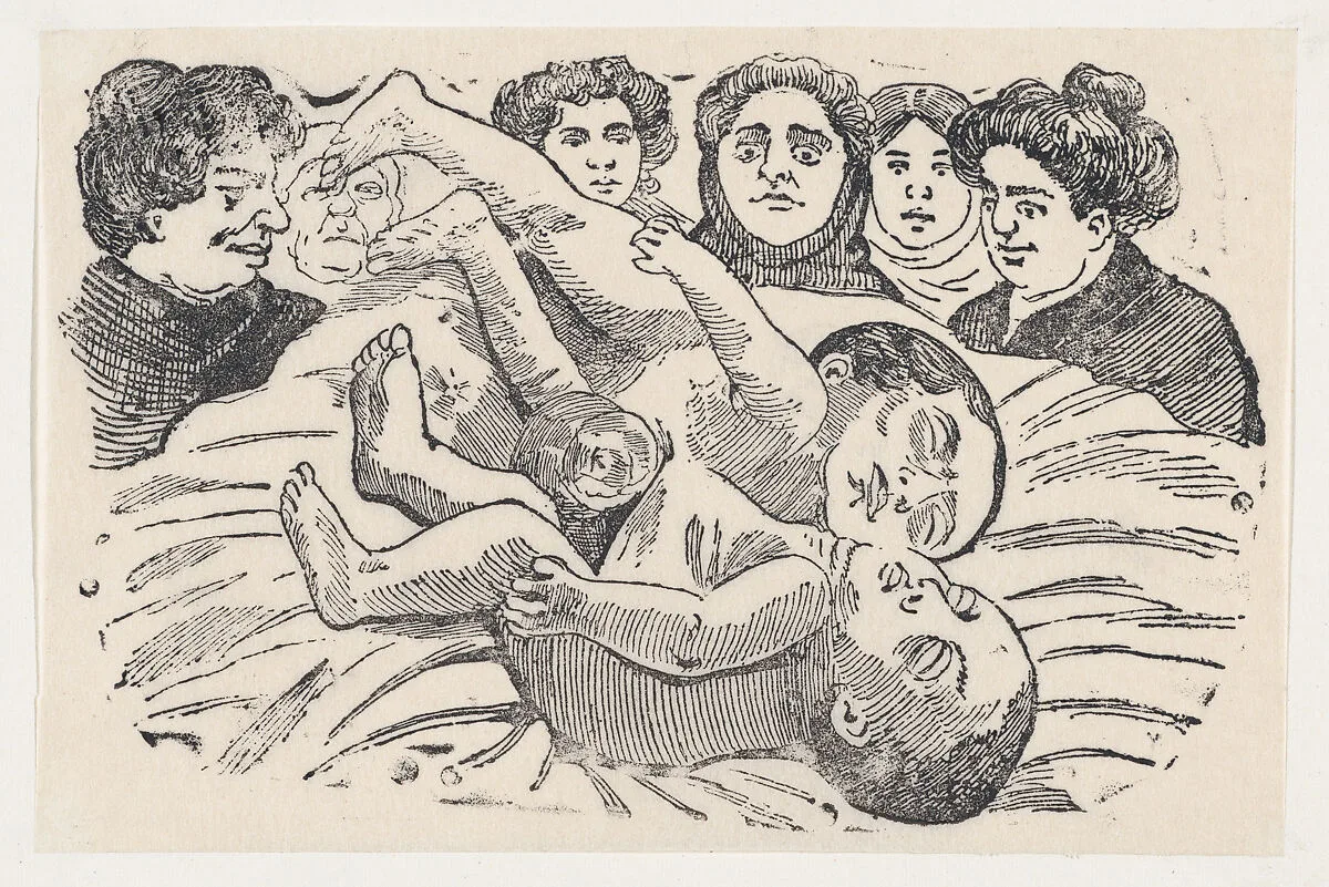 Siamese Twins — José Guadalupe Posada
