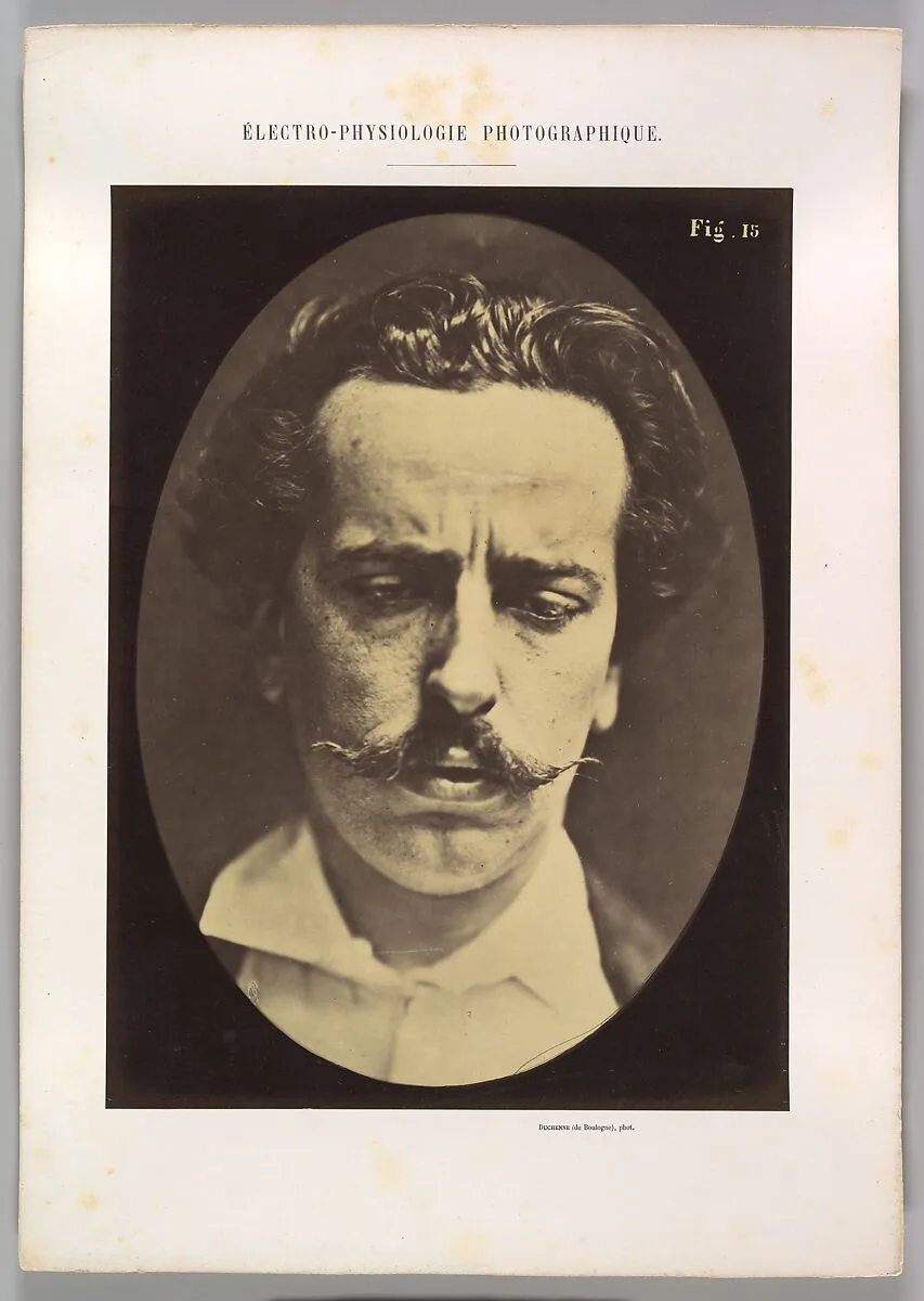 Figure 15: Mediation, mental concentration — Guillaume-Benjamin-Amand Duchenne de Boulogne|Adrien Tournachon