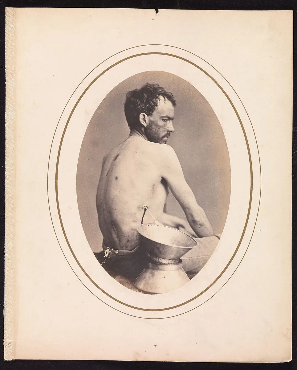 Corporal Israel Spotts, Company G, 200th Pennsylvania Volunteers — Reed Brockway Bontecou