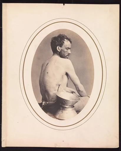 Corporal Israel Spotts, Company G, 200th Pennsylvania Volunteers