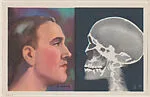 X-Rays from Modern Wonders of the World Educational Pictures (W608-5) — Unknown