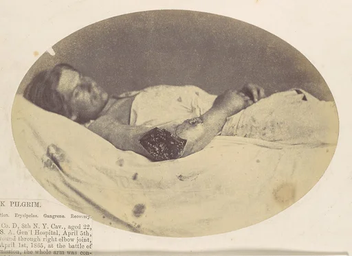 Frederick Pilgrim