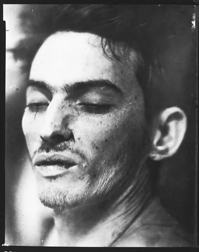 [Copy of Newspaper File Photograph: Head of Corpse, Probably Havana]