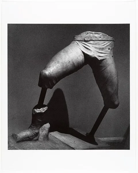 The Amputee — John Gutmann