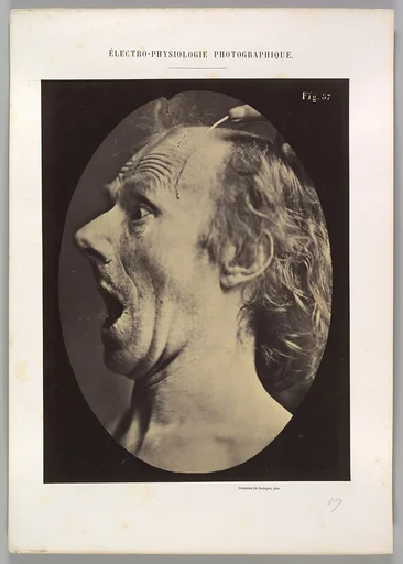 Figure 57: Astonishment, stupefaction, amazement
