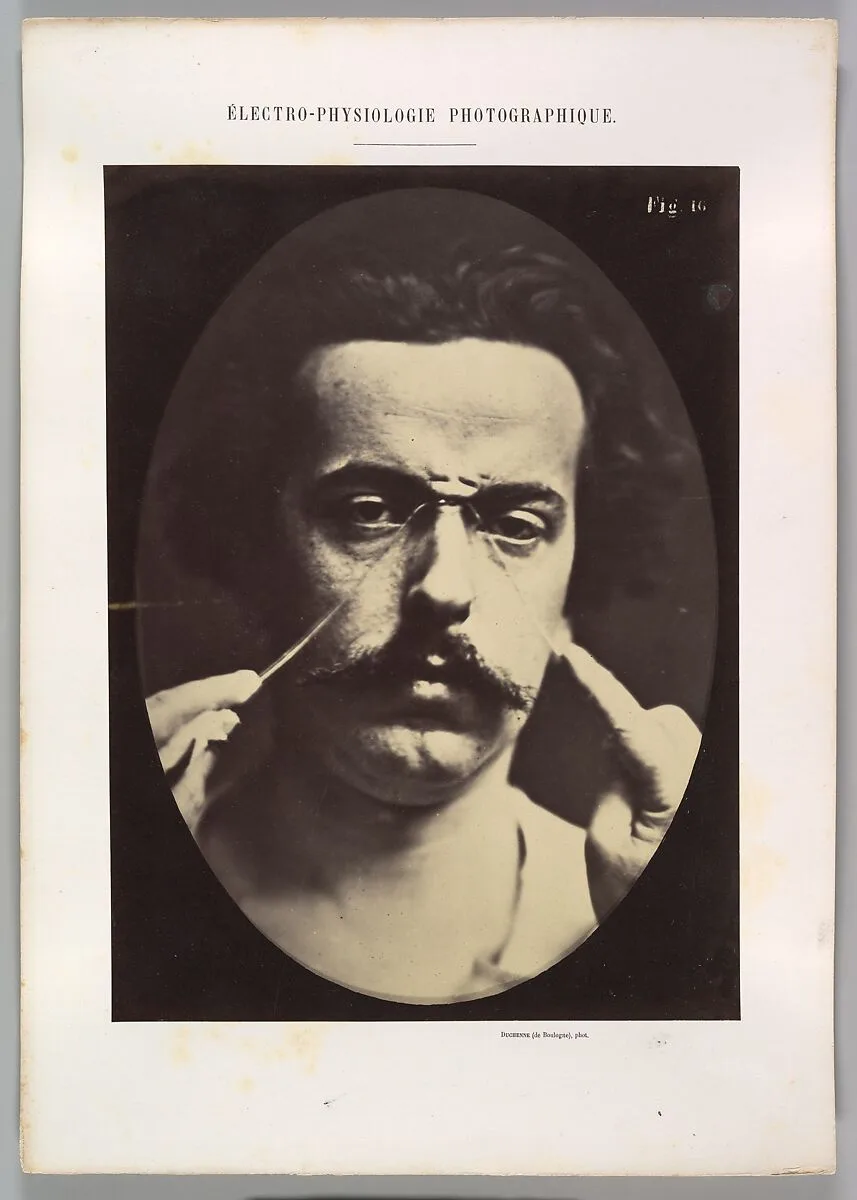 Figure 16: Expression of severity — Guillaume-Benjamin-Amand Duchenne de Boulogne|Adrien Tournachon