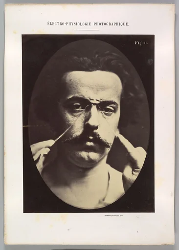 Figure 16: Expression of severity