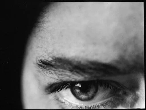 [Eye]
