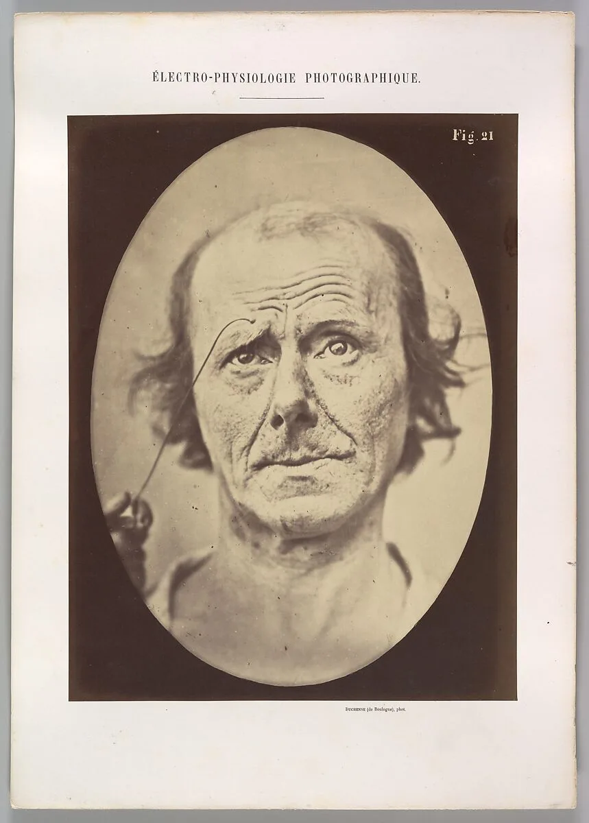 Figure 21: Painful recollection and recollection or calling something to mind — Guillaume-Benjamin-Amand Duchenne de Boulogne|Adrien Tournachon