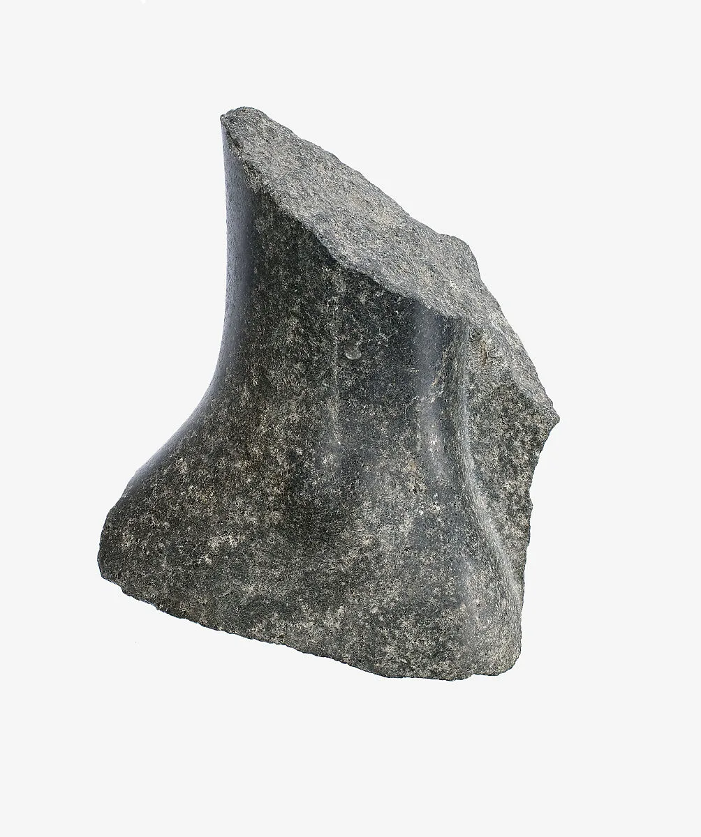 Left ankle — Unknown