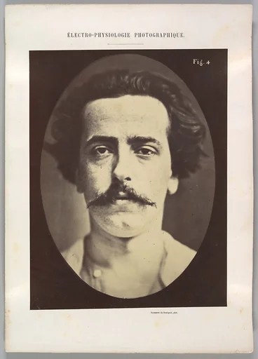 Figure 4: The face in repose of a young man
