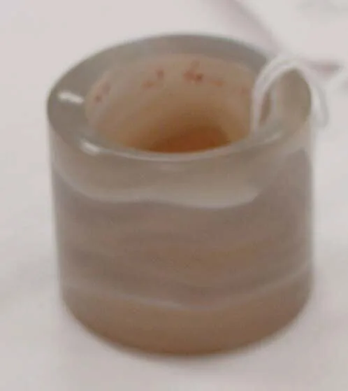 Ring — Unknown