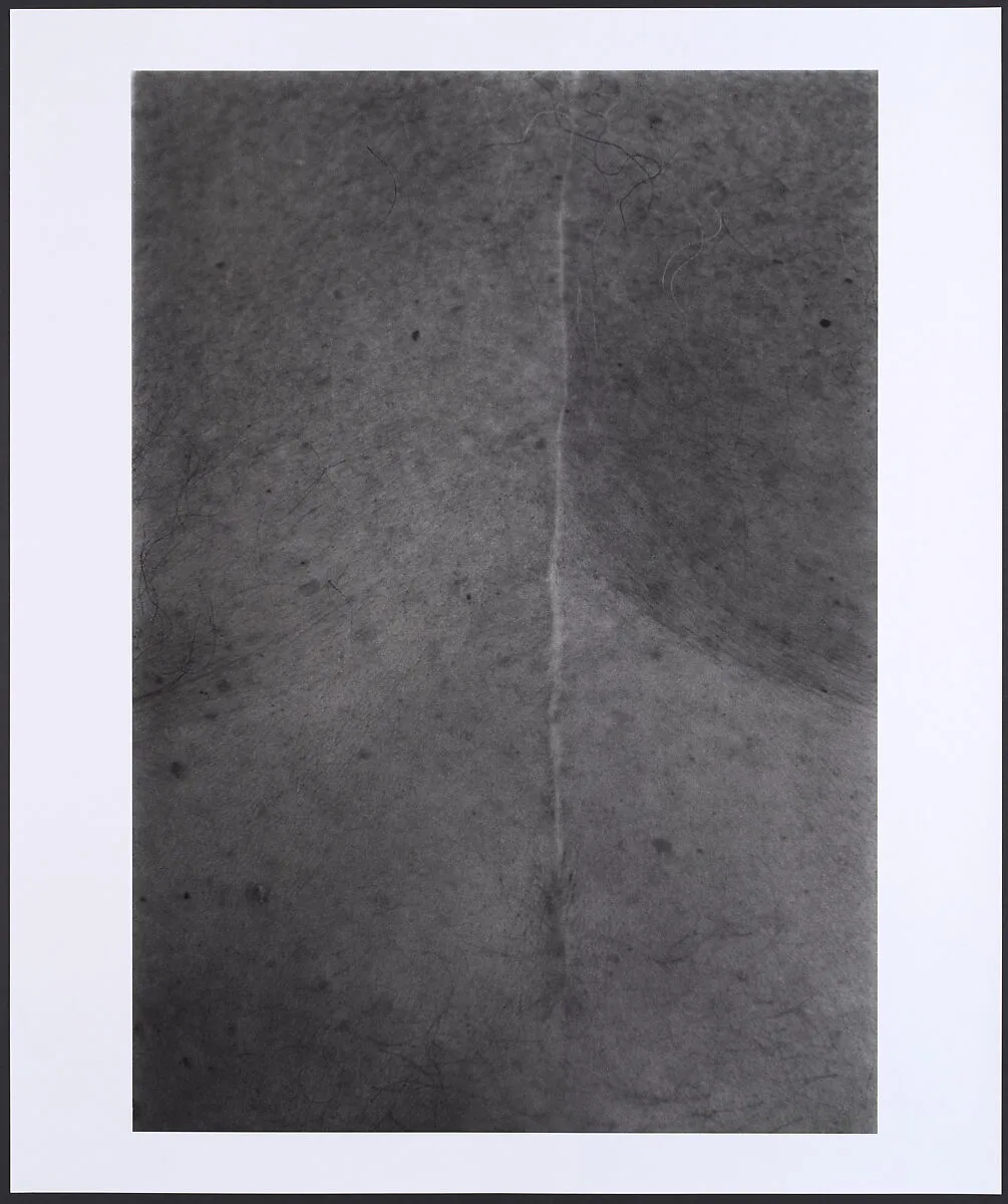 Scar #22, Illness-1984, New York — Ishiuchi Miyako